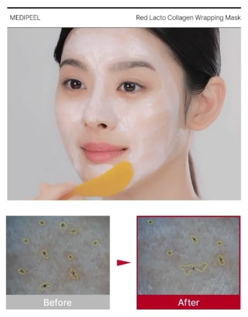 MEDI-PEEL - Red Lacto Collagen Wrapping Mask 70ml