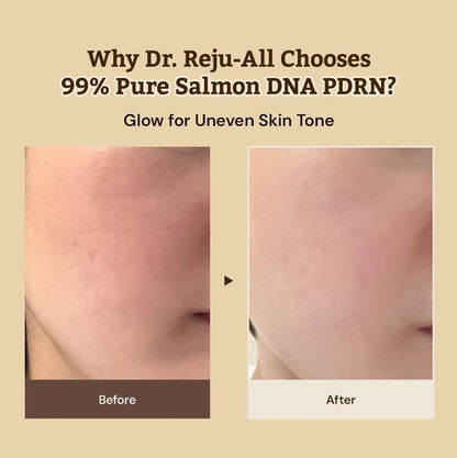 Dr.Reju-All - Advanced PDRN Rejuvenating Cream 20ml