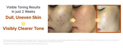 SUNGBOON EDITOR - Kojic Acid Niacinamide Brightening Ampoule 40ml