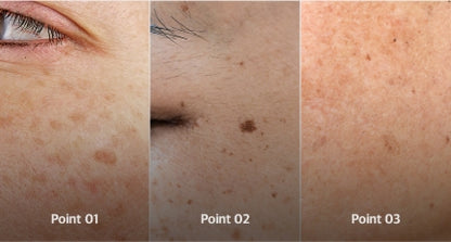 MEDIPEEL - Melanon X Cream 30ml