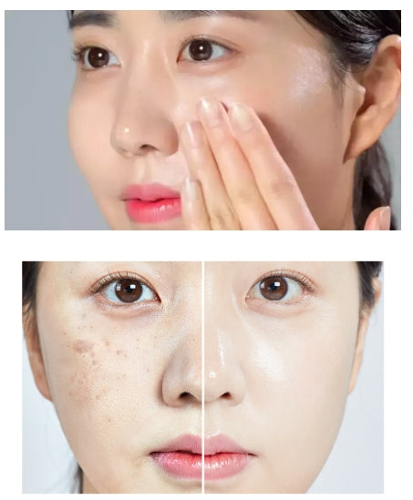 MEDIPEEL - Melanon X Cream 30ml