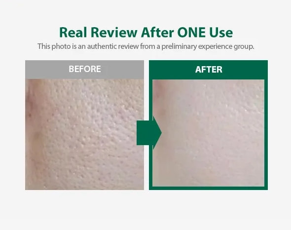 SUNGBOON EDITOR - Green Tomato Deep Pore Cleansing Ultra Whipping Foam 120ml