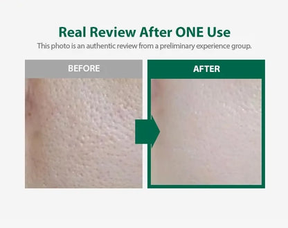 SUNGBOON EDITOR - Green Tomato Deep Pore Cleansing Ultra Whipping Foam 120ml